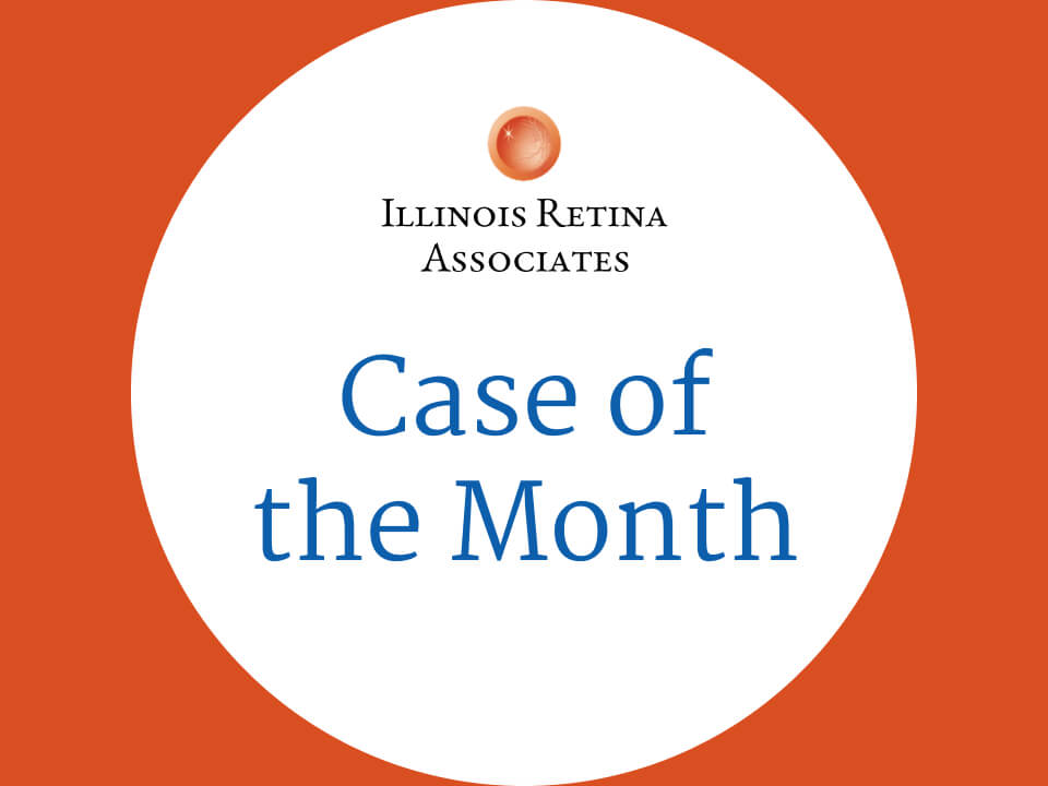 Macular Edema - Patients - The American Society of Retina Specialists
