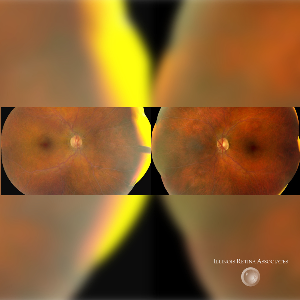 Fundus Photos